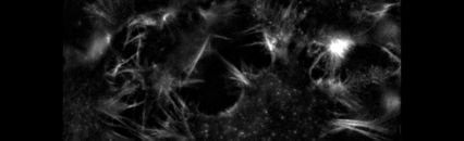 K5 - SCMOS显微镜相机