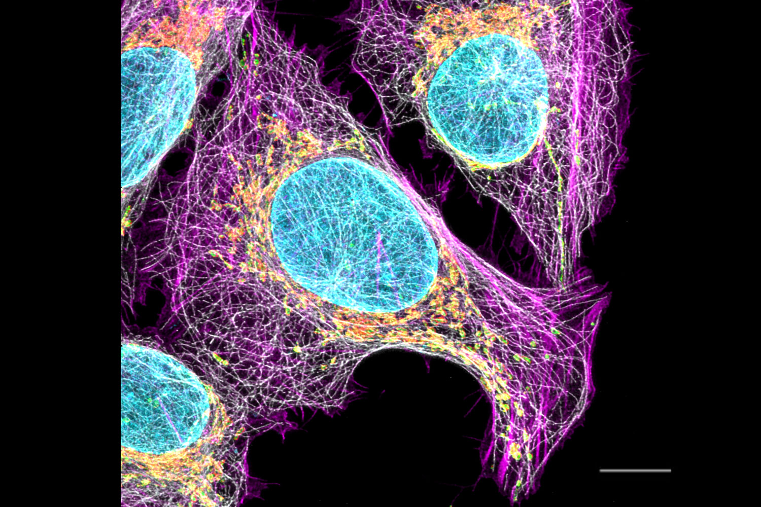 LIGHTNING image overlay shows the maximum projection of a z-stack from fixed U2OS cells labelled with 5 color