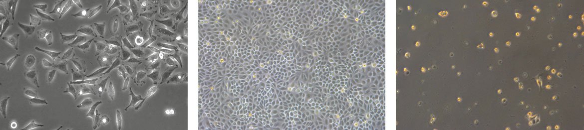 成纤维细胞样，上皮样和淋巴细胞样细胞（从左到右）。
